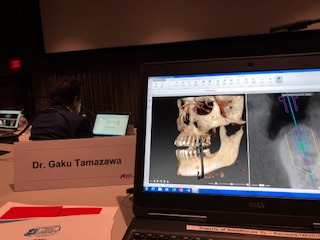 ロサンゼルス　Dr.Paulo Malo & Dr.Peter Wohrle プライベート研修①