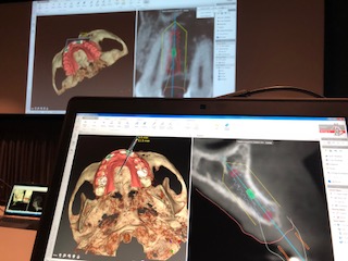 ロサンゼルス　Dr.Paulo Malo & Dr.Peter Wohrle プライベート研修②