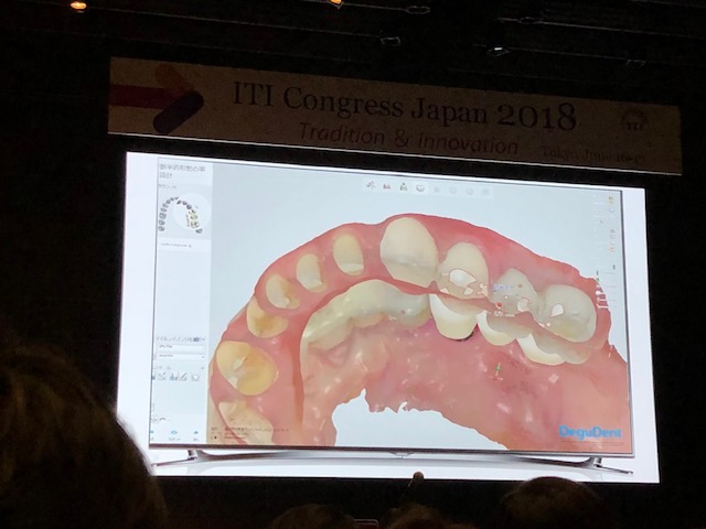 ITI Congress Japan Tokyo 2018