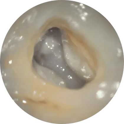 マイクロスコープ